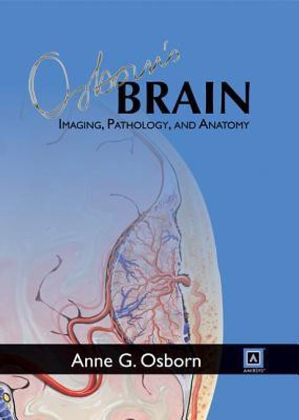 diagnostic imaging brain osborn